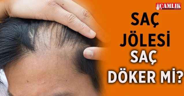 Saç Jölesi Saç Döker mi? Saç Jölesi Neyden Yapılır?