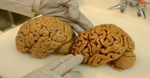 Tarçın’ın mucizeleri saymakla bitmiyor! Alzheimer’a iyi geliyor!