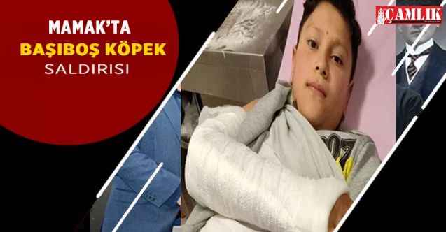 Mamak'ta sokak köpeği saldırısı: 2 çocuk ağır yaralandı!