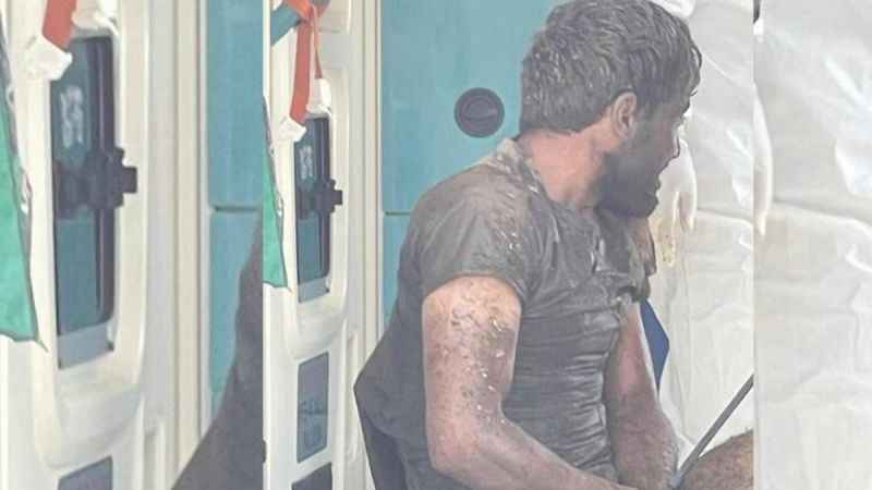 Kuduz teşhisiyle tedavi gören kişi yaşamını yitirdi