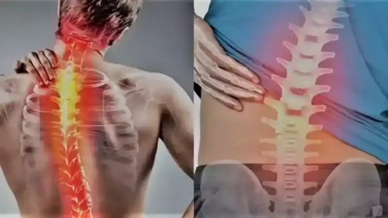 Skolyoz Nedir?