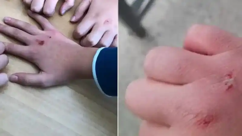 Kanlı Para Oynamak Caiz mi? Cezası Var mı?