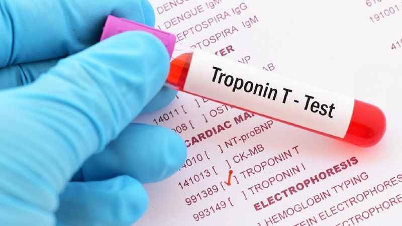 Troponin Testi Ne İşe Yarar? Kalp Sağlığına Baktırmak İçin Troponin Kontrolünün Önemi!
