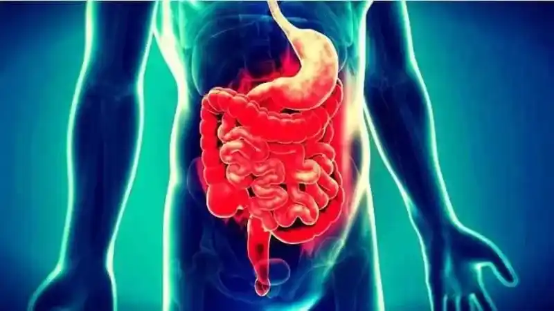 Crohn Hastalığı Nedir? Crohn Hastalığının Belirtileri Neler? Crohn Hangi Organda Görülür?