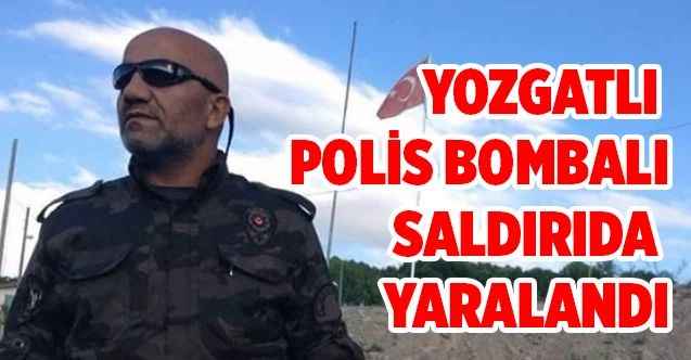 Yozgatlı polis bombalı saldırıda yaralandı
