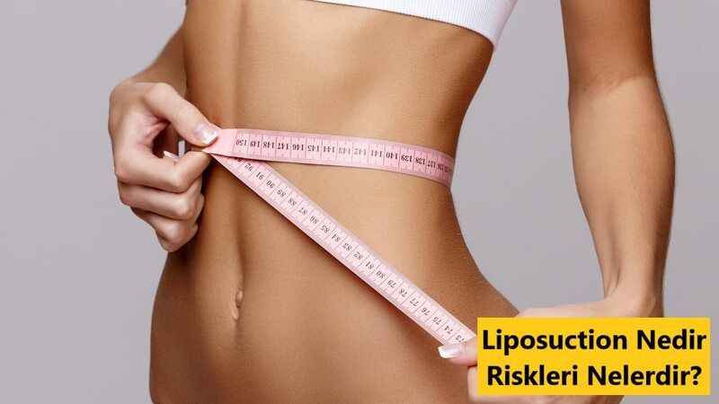 Liposuction Nedir?