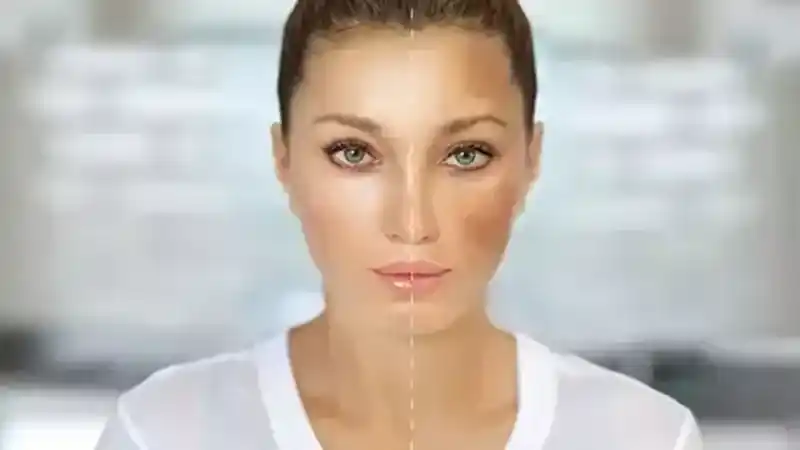 Dermatoloji Uzmanı Uyarıyor: Cilt Lekeleri Hastalık Belirtisi Olabilir!