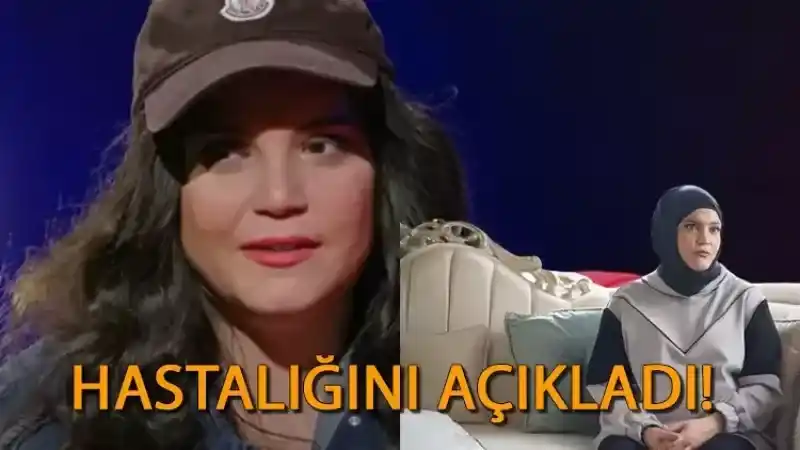 Feyza Civelek Neden Peruk Takıyor?