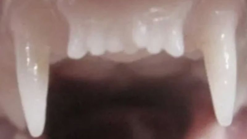 Kaybedilen Dişlerin Yeniden Çıkması İçin İnsanlı Testler Başlıyor!