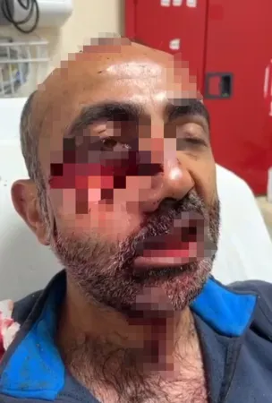 Dikkat karşınıza ayı çıkabilir! İki ayı köylü vatandaşa saldırdı