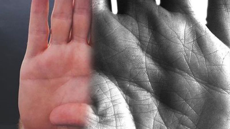 Simian Çizgisi Nedir?