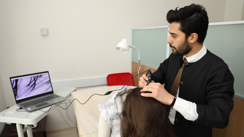 Yozgat Bozok Üniversitesi Saç Dökülmesi Tedavisinde İleri Adımlar Atıyor
