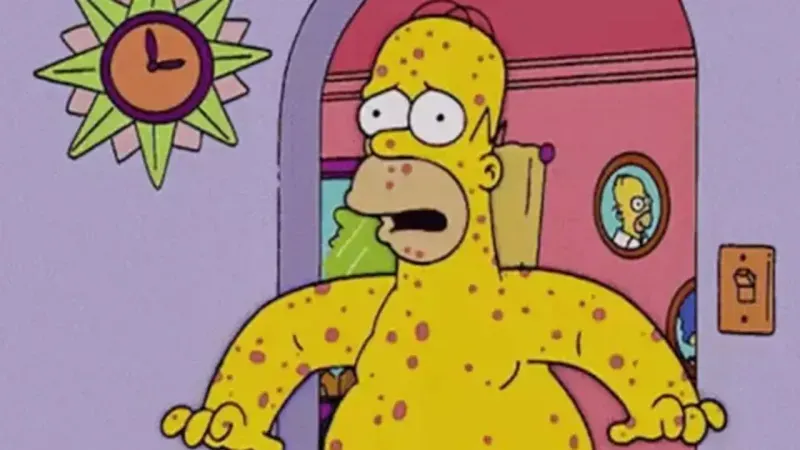 The Simpsons Yine Gündemde: Maymun Çiçeği Salgını Öngörüsü Gerçek Mi Oldu?