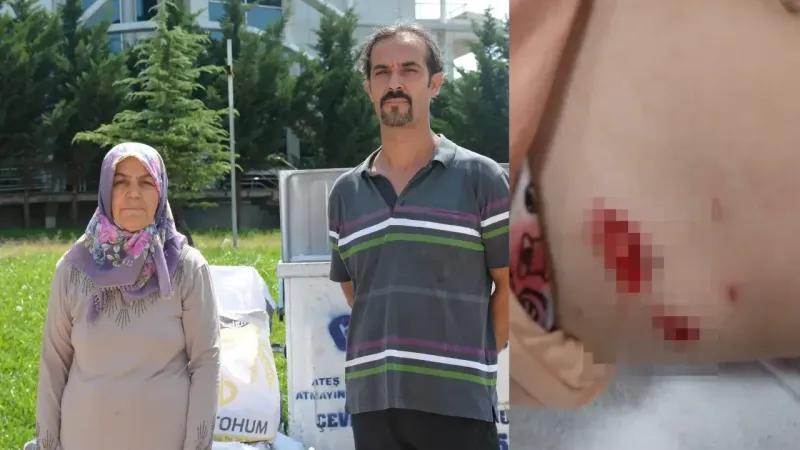 Başıboş Köpekler 5 Yaşındaki Kıza Saldırdı!