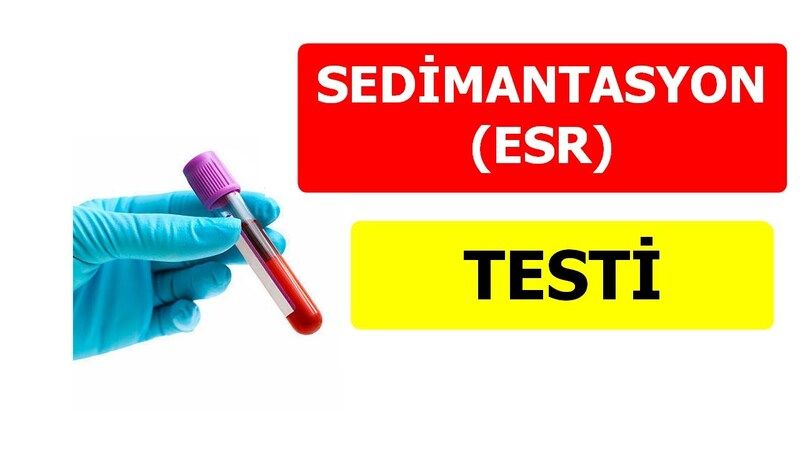 Sedimantasyon Neden Yüksek Çıkar? Anlamı ve Etkileri