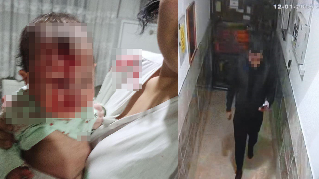 Keçiören’de 4 Aylık Bebeğini Cam Sehpanın Üzerine Attı
