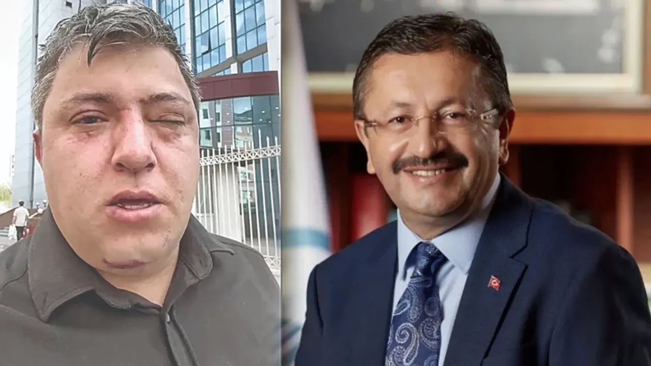 Altındağ Belediyesi’nde Şiddet İddiası