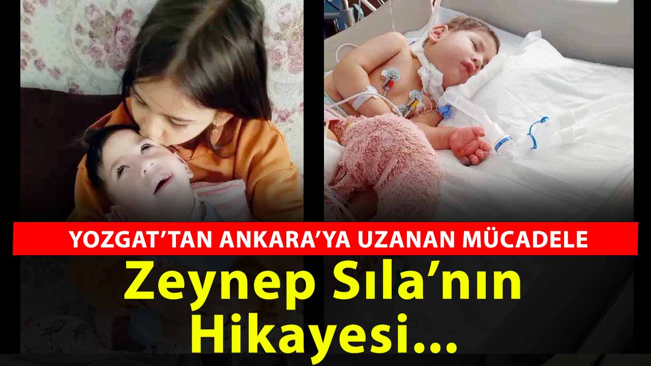 Yozgatlı Annenin Özel Gereksinimli Kızı Zeynep Sıla'nın Zorlu Yolculuğu