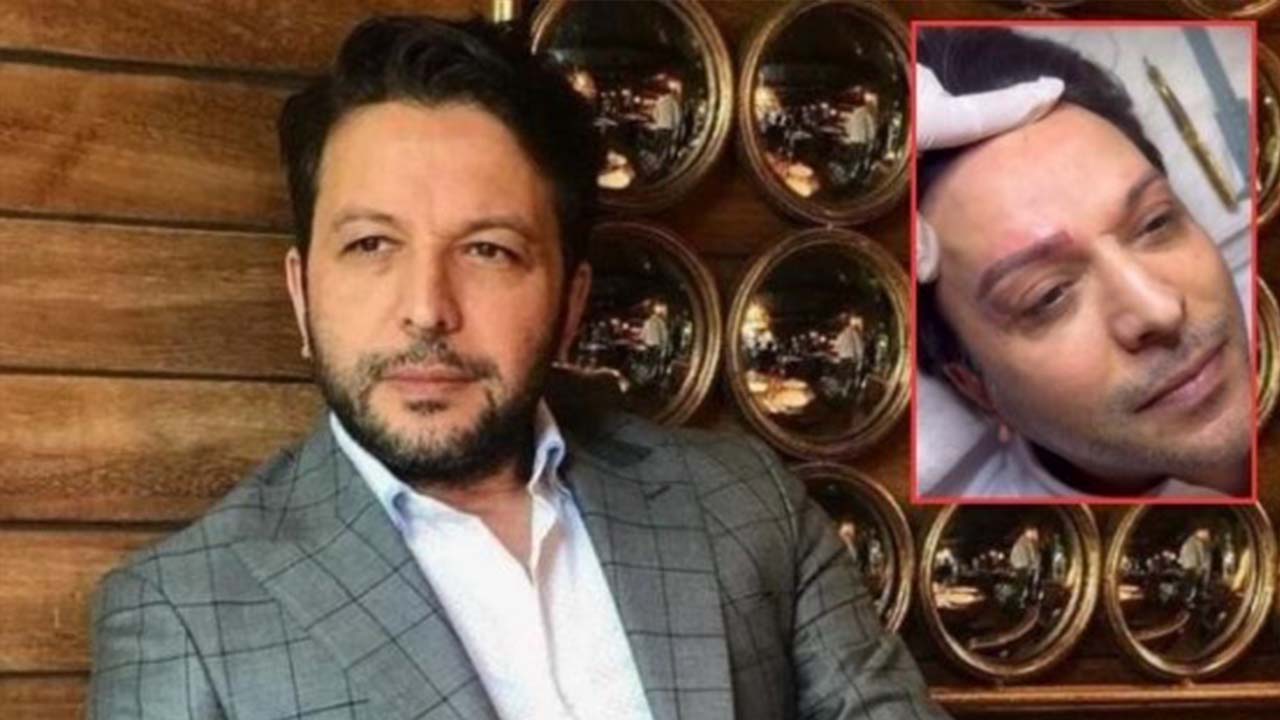 Nihat Doğan Estetik Yaptırdı! Son Halini Görenler İnanamadı