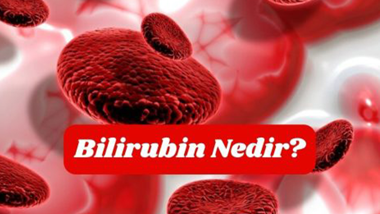 Bilirubin Direkt Yüksekliği Nedir