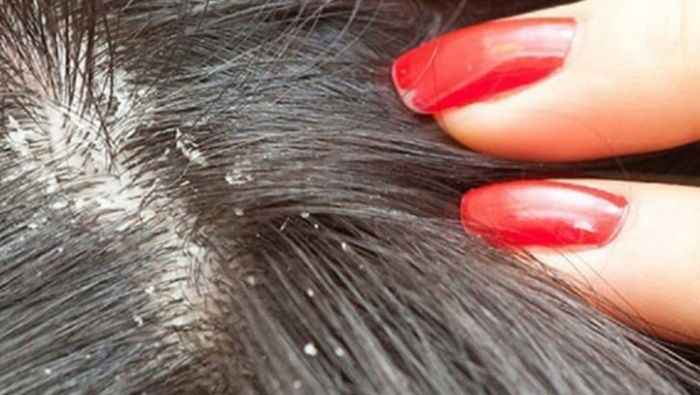 Okulda Bit Bulaşmaması İçin Ne Yapılmalı