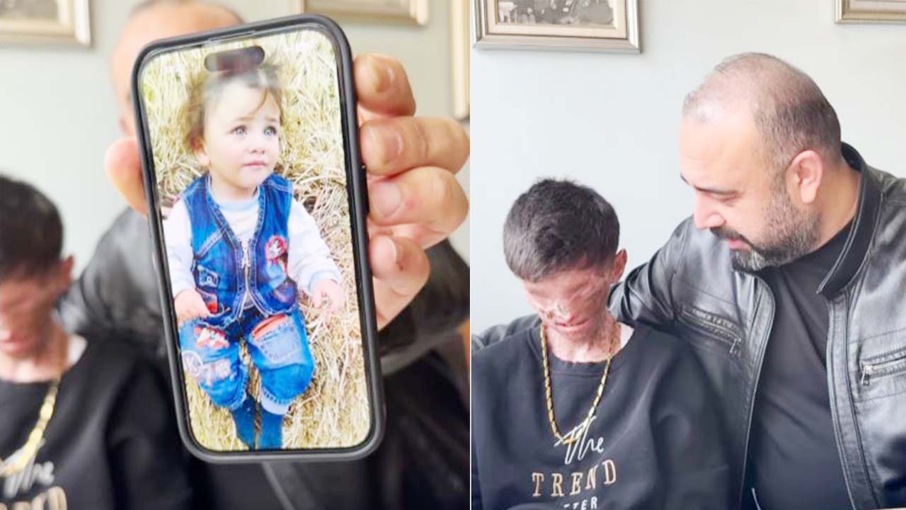 Ankara Abisi 13 Yaşındaki Salih’in Hayaline Dokundu: İlk Ameliyat Gerçekleşti!