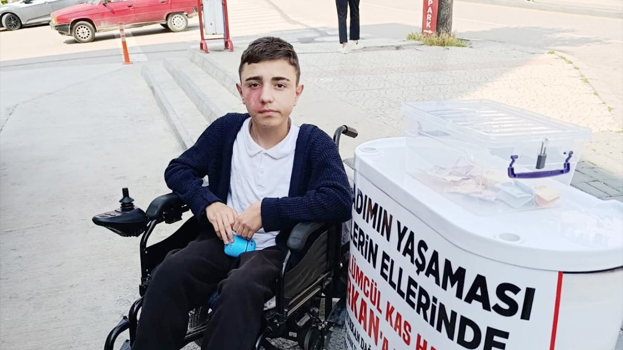 Furkan’ın Hayalleri Kaslarına Yenilmesin