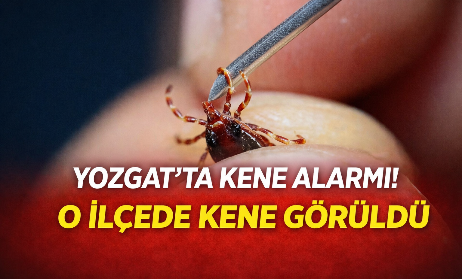 Yozgat’ta Kene Alarmı! O İlçede Kene Görüldü