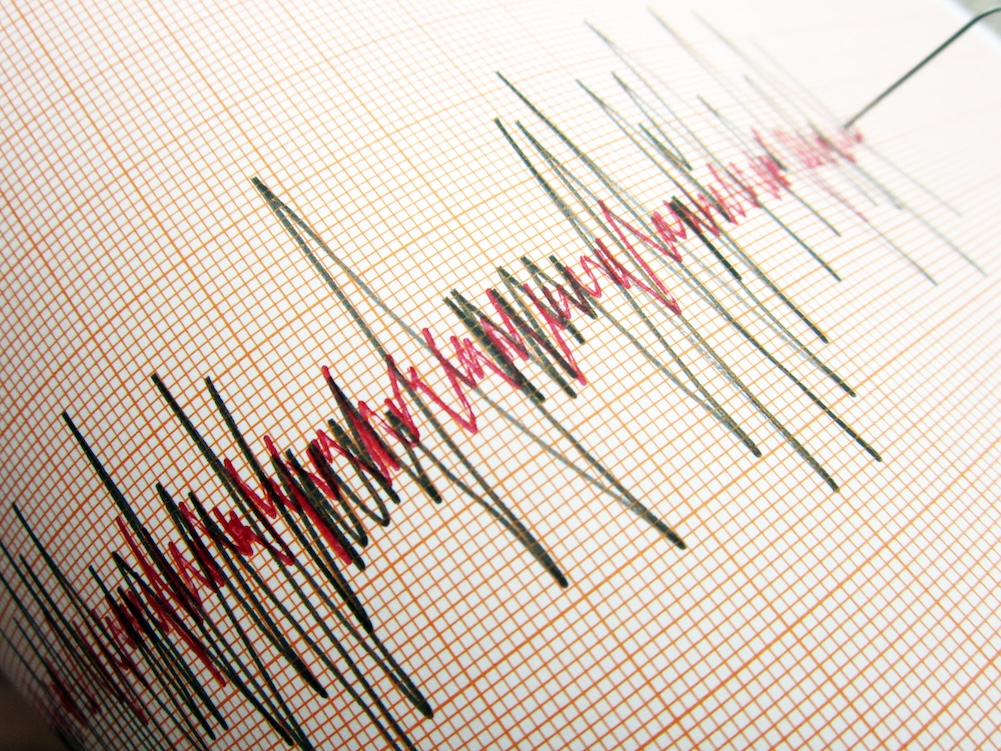 Yozgat İçin Kritik Deprem Uyarısı: Bu İlçelerde Risk Daha Yüksek Olabilir!