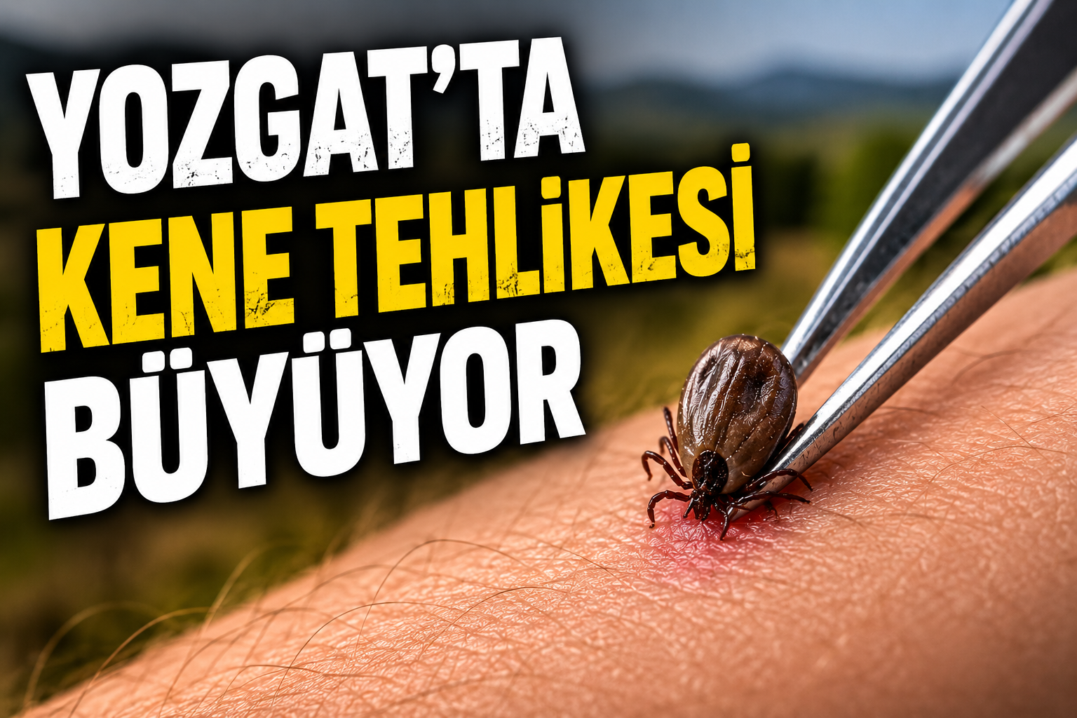 Uzmanlar Yine Uyardı: Yozgat’ta Kene Tehlikesi Büyüyor