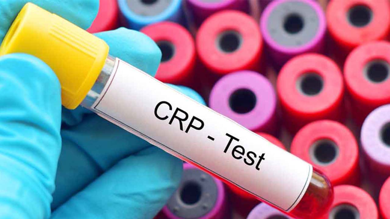 C Reaktif Protein Yüksekliği Nedir