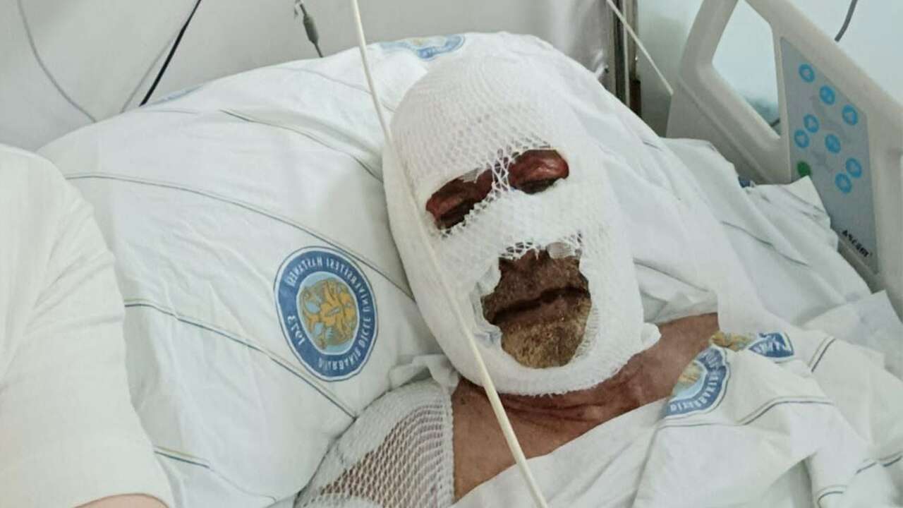 Cizre’ye ekmek parası için gitmişti: Yozgatlı hemşehrimiz yangında ağır yaralandı