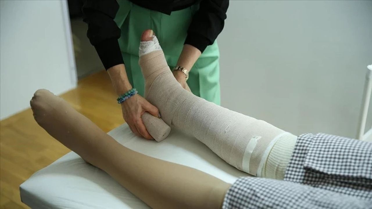 Lipödem Tedavi Edilmezse Yürümek Bile Zorlaşıyor-1