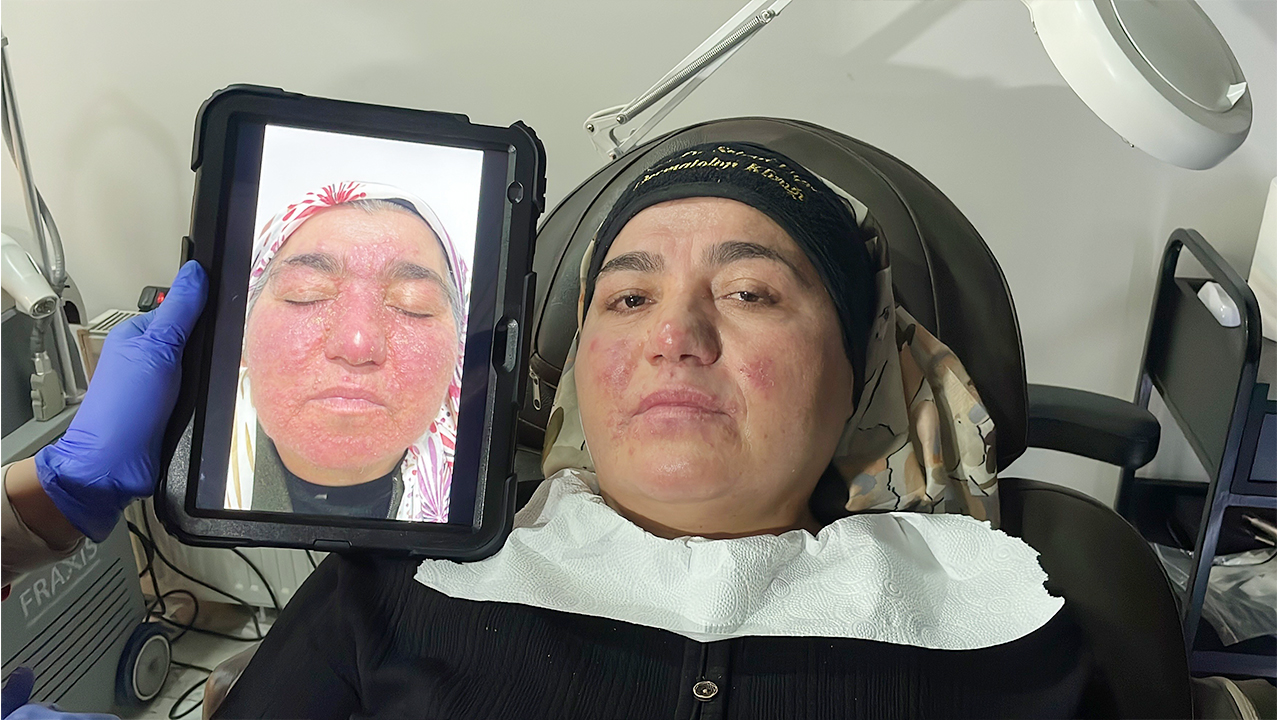 Şifayı Buldu (2)