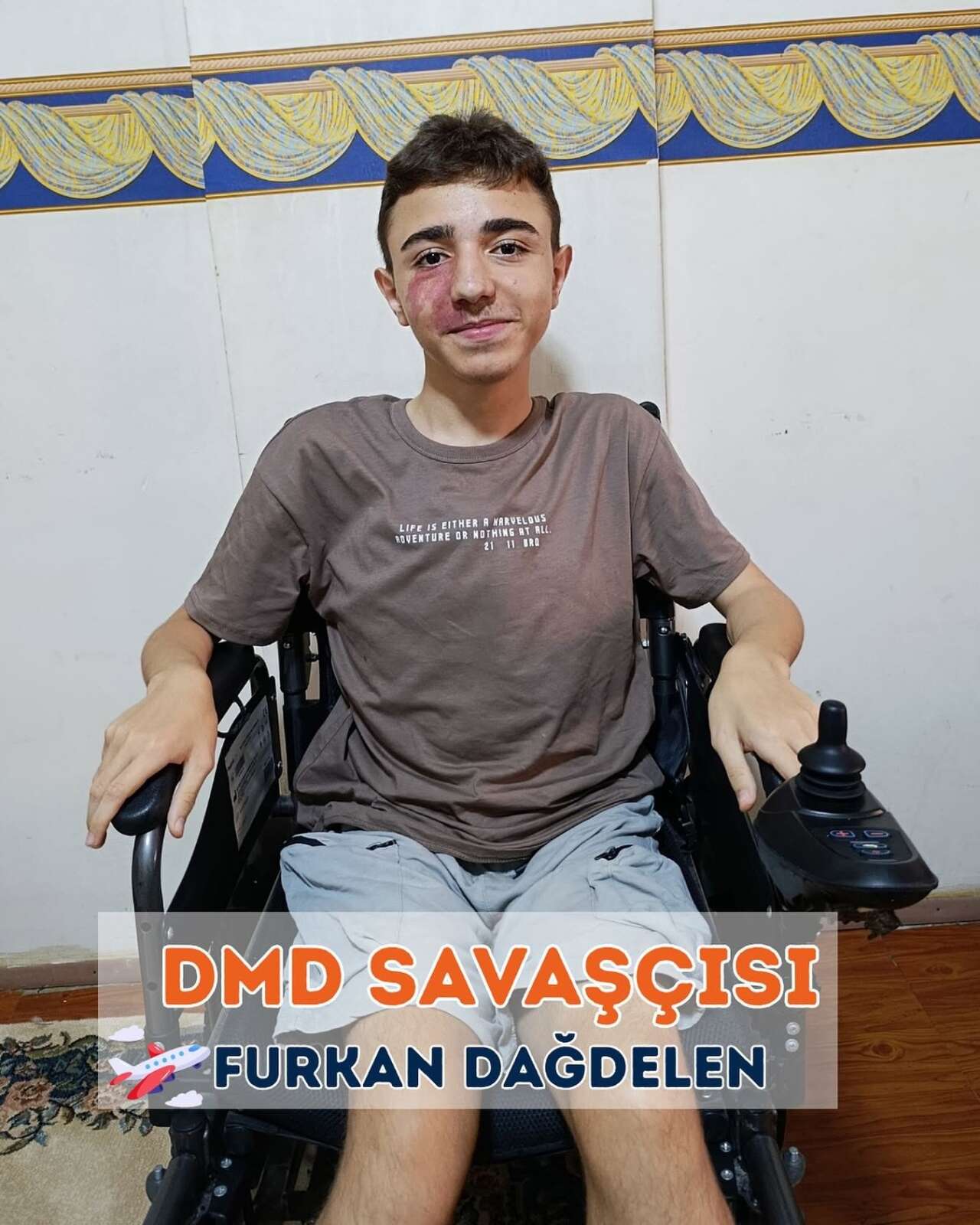 dmd-furkan